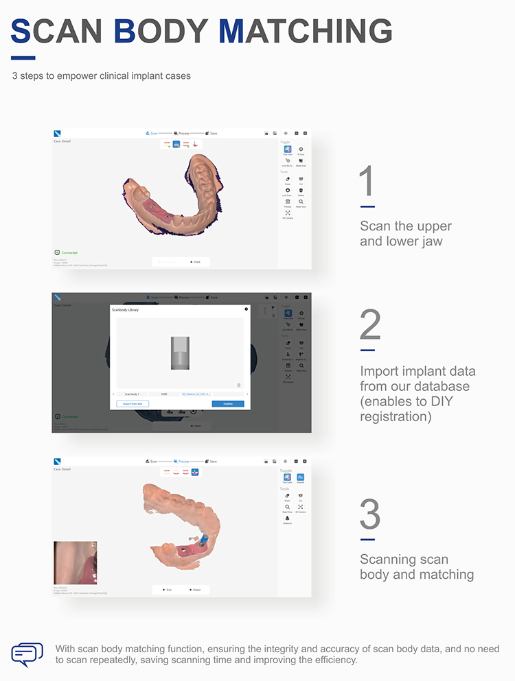 IOS33 Intraoral Scanner